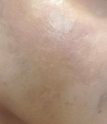 Radhika after using Dream Petals