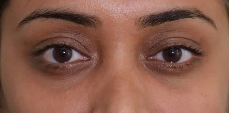 Ishita after using Dream Petals