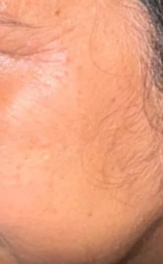 Reeta Mehta after using Dream Petals